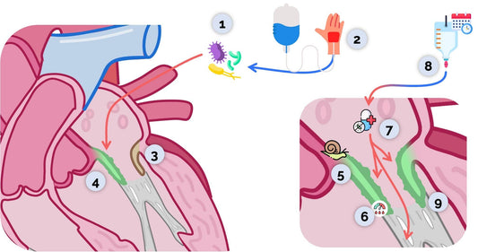 Endokarditis Pathophysiologie 🦠