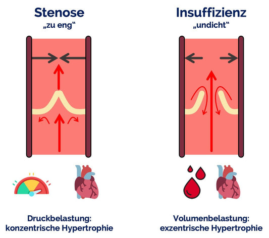 Herzklappenfehler (Vitium) erklärt 🫀💡