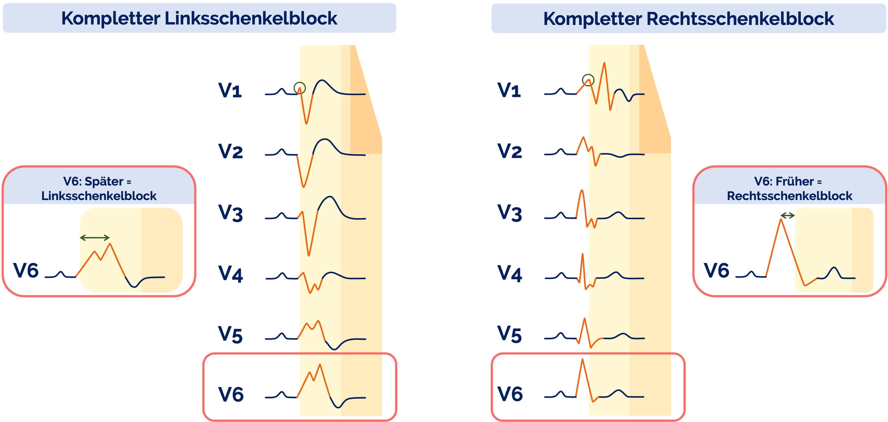 schenkelblockemitdiesemtrickunterscheiden800276.jpg?v=1704912183