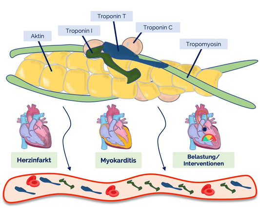 Troponin Wert interpretieren 🫀💡