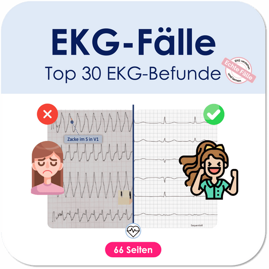 EKG-Fälle-Skript - Medi Know