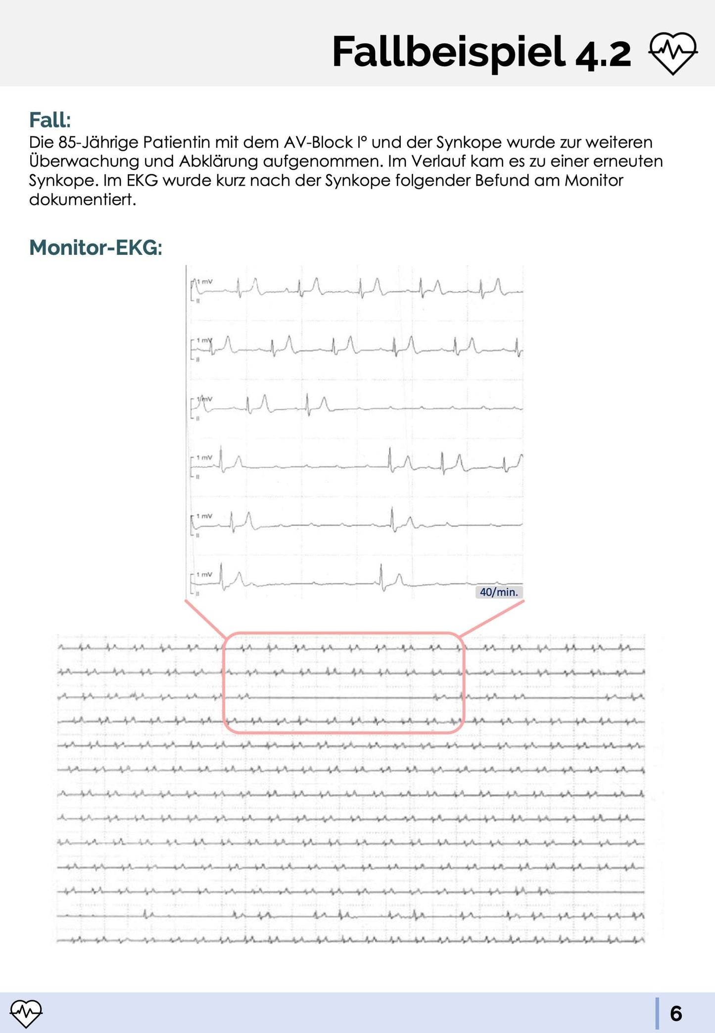 EKG-Premium-Paket