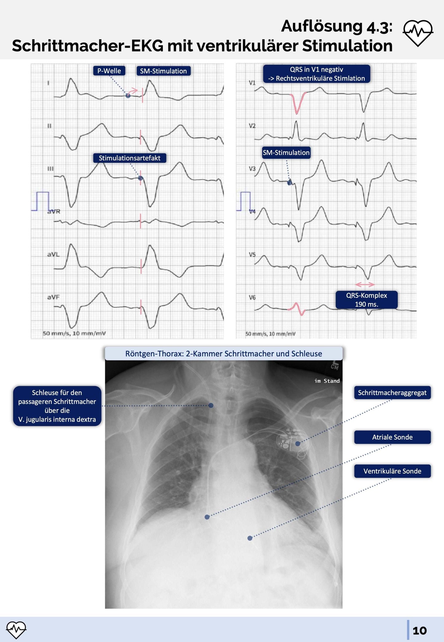 EKG-Premium-Paket