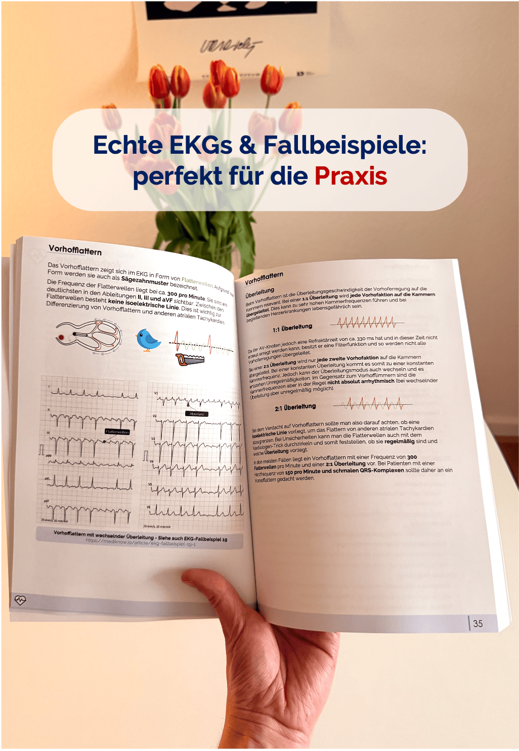 EKG-Skript (ausgedruckt + Versand)