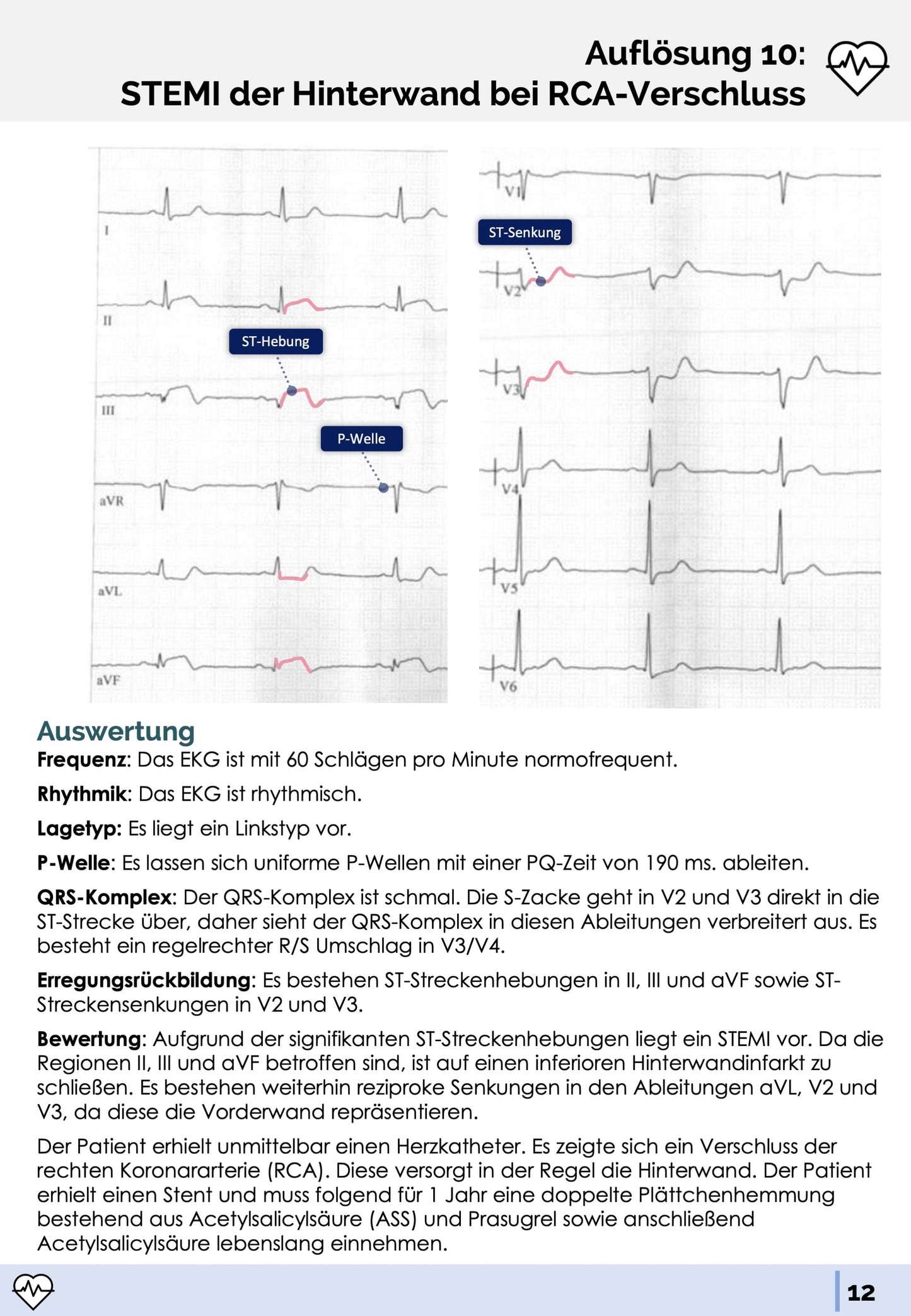 EKG-Fälle-Skript - Medi Know