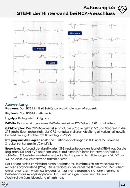 EKG-Fälle-Skript - Medi Know