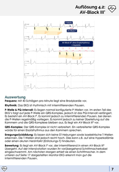 EKG-Fälle-Skript - Medi Know