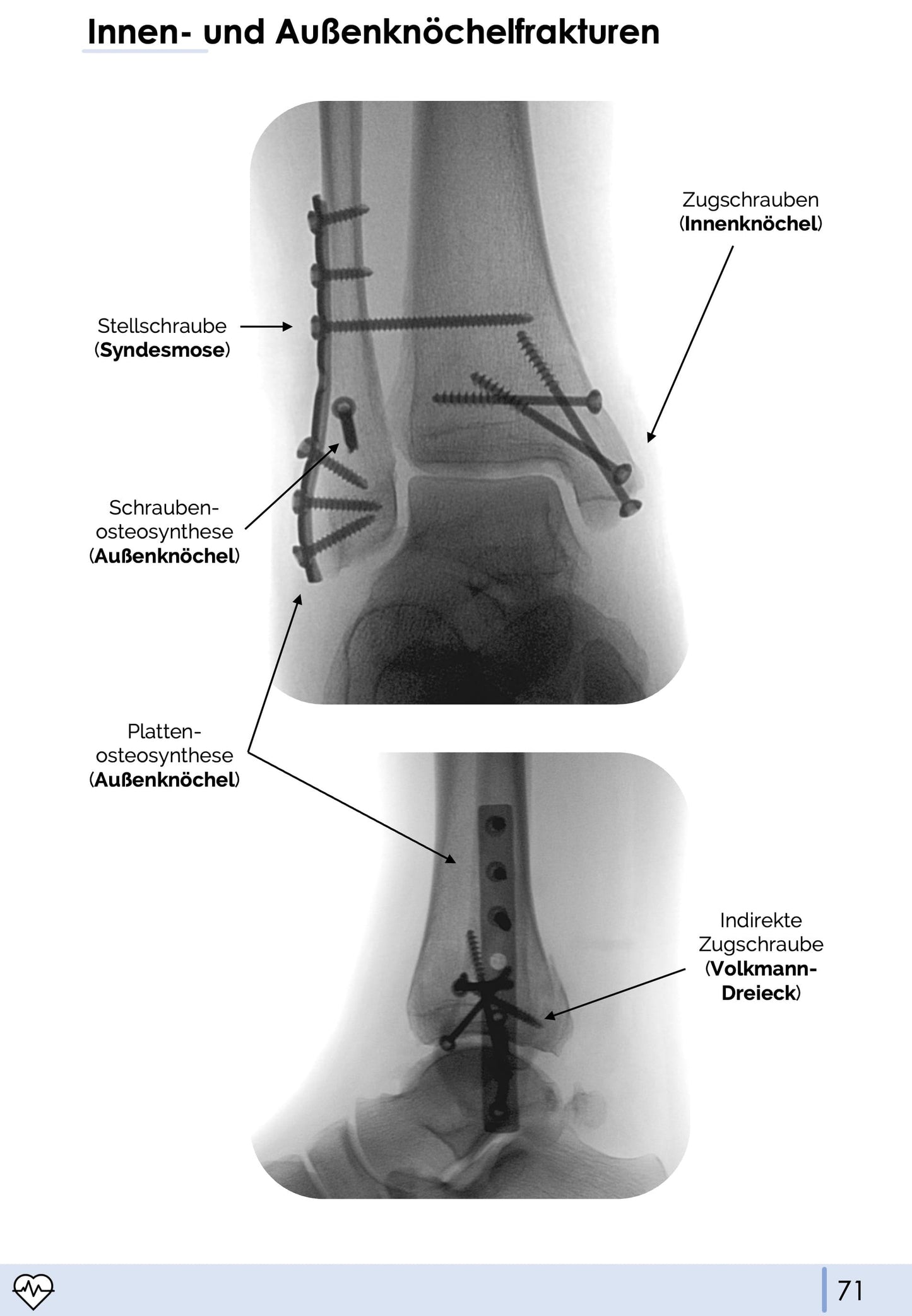 Unfallchirurgie und Orthopädie-Skript - Medi Know