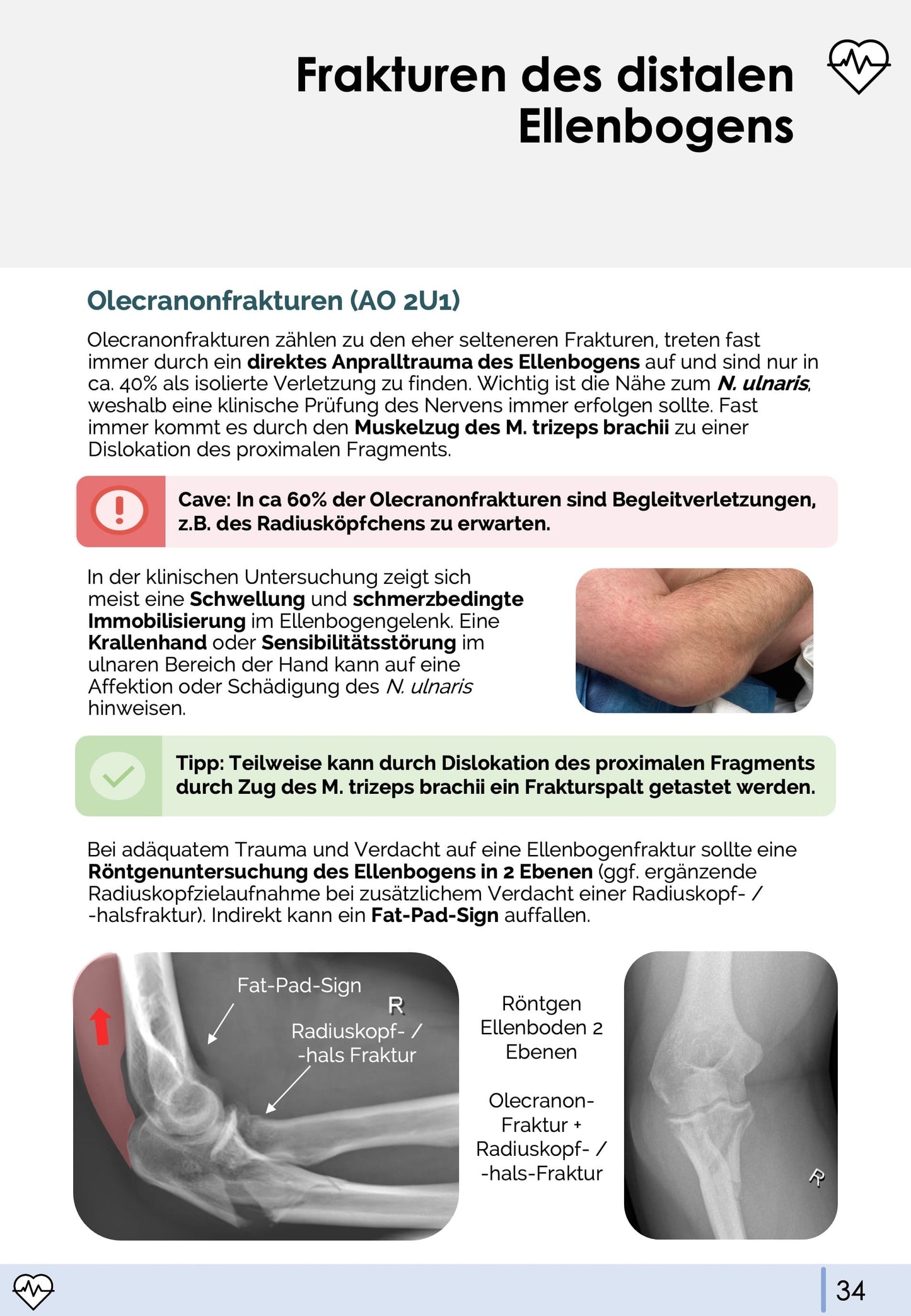 Unfallchirurgie und Orthopädie-Skript - Medi Know