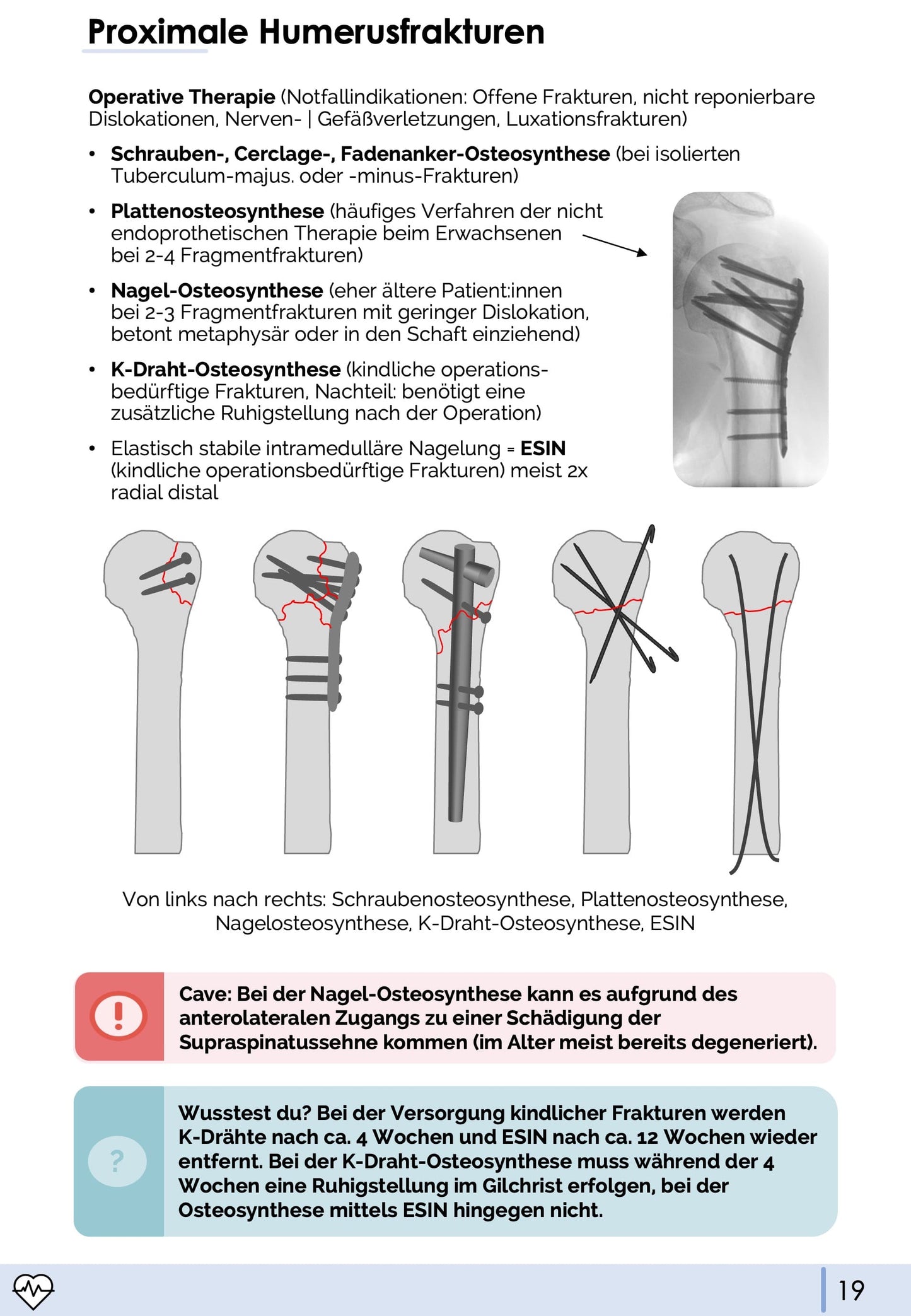 Unfallchirurgie und Orthopädie-Skript - Medi Know