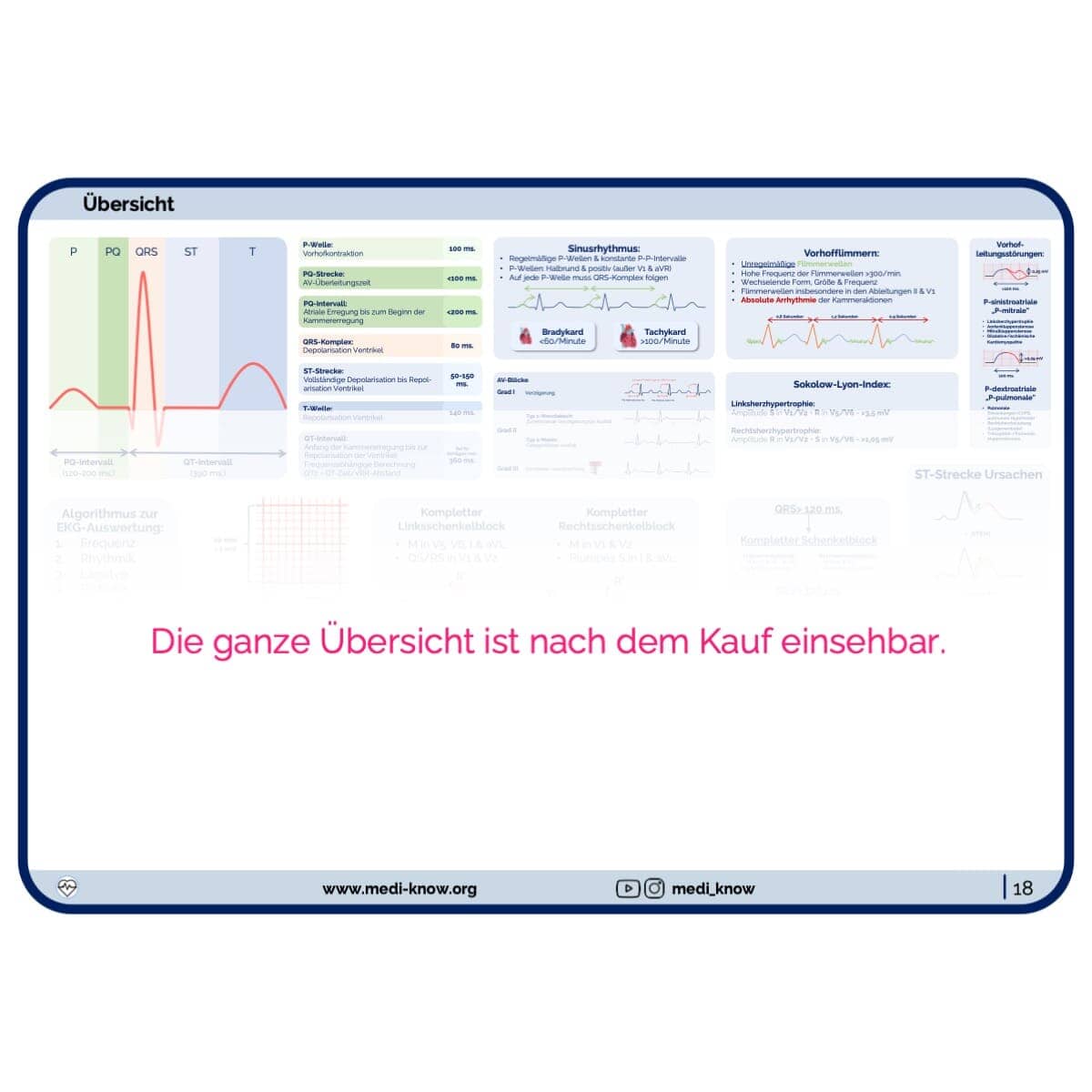 EKG-Lernkarten Übersichten Medi Know