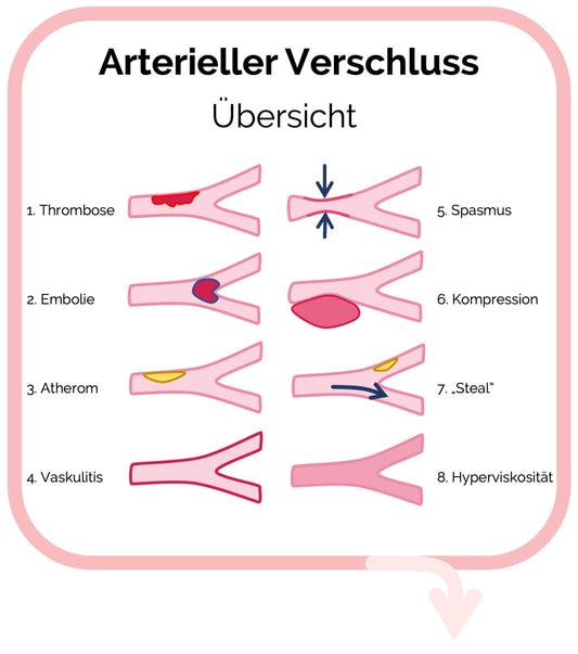 Arterieller Verschluss: so erkennst du ihn klinisch 👁️