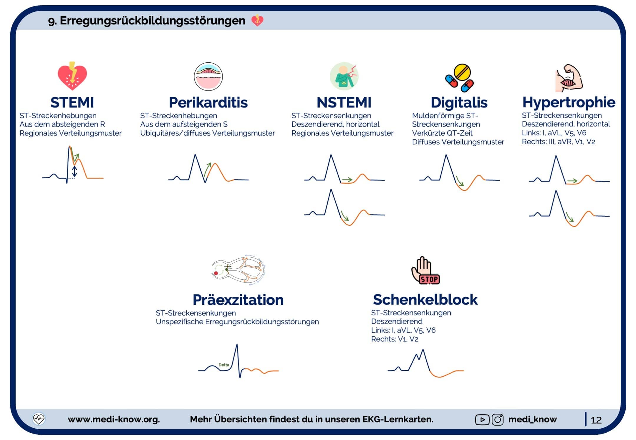 erregungsruckbildungsstorungenimekgunterscheiden368321.jpg?v=1704912167