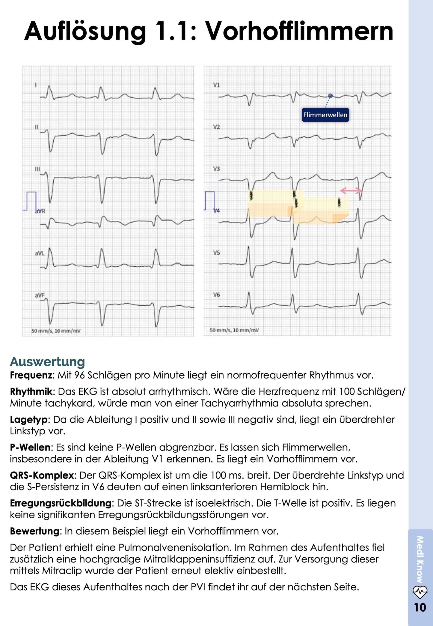 EKG-Skript