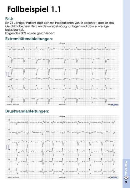 EKG-Skript