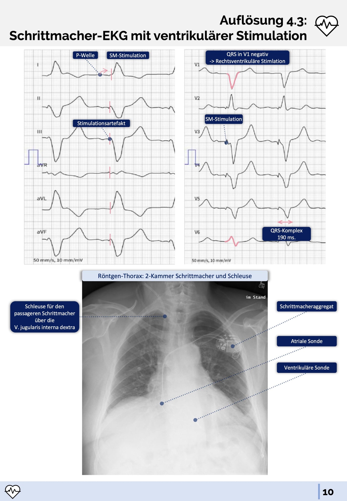 EKG-Fälle-Skript - Medi Know