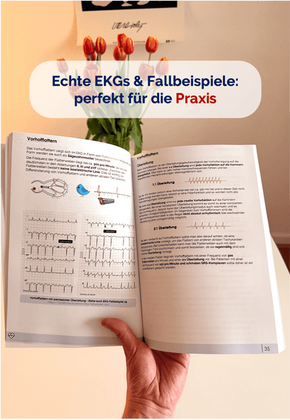 EKG-Skript (ausgedruckt + Versand)