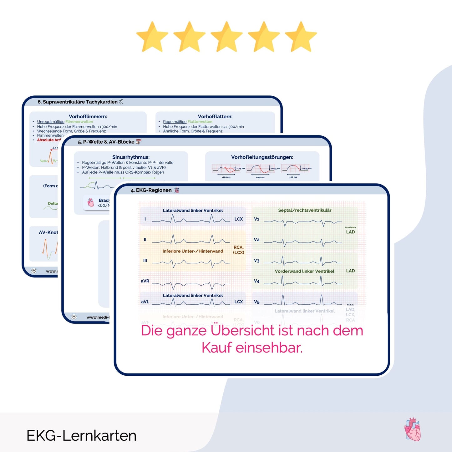 EKG-Lernkarten