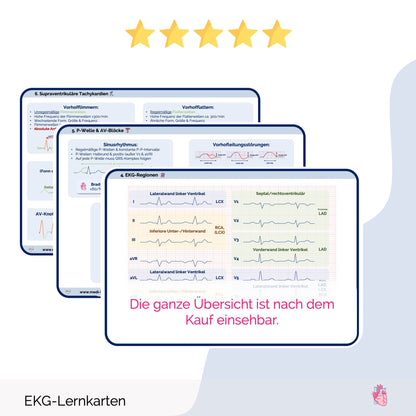 EKG-Lernkarten