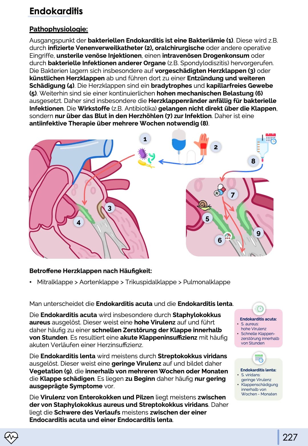 Endokarditis