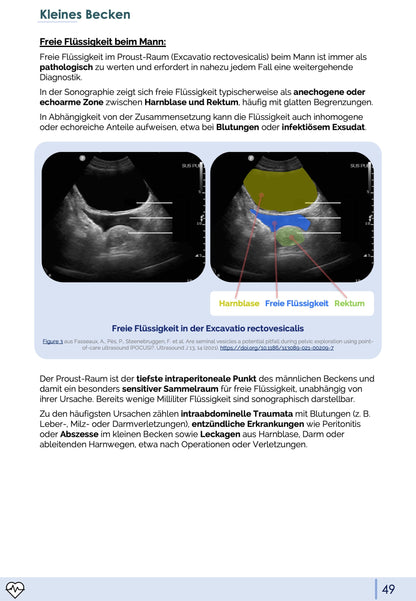Notfall-Sonographie (eFAST)