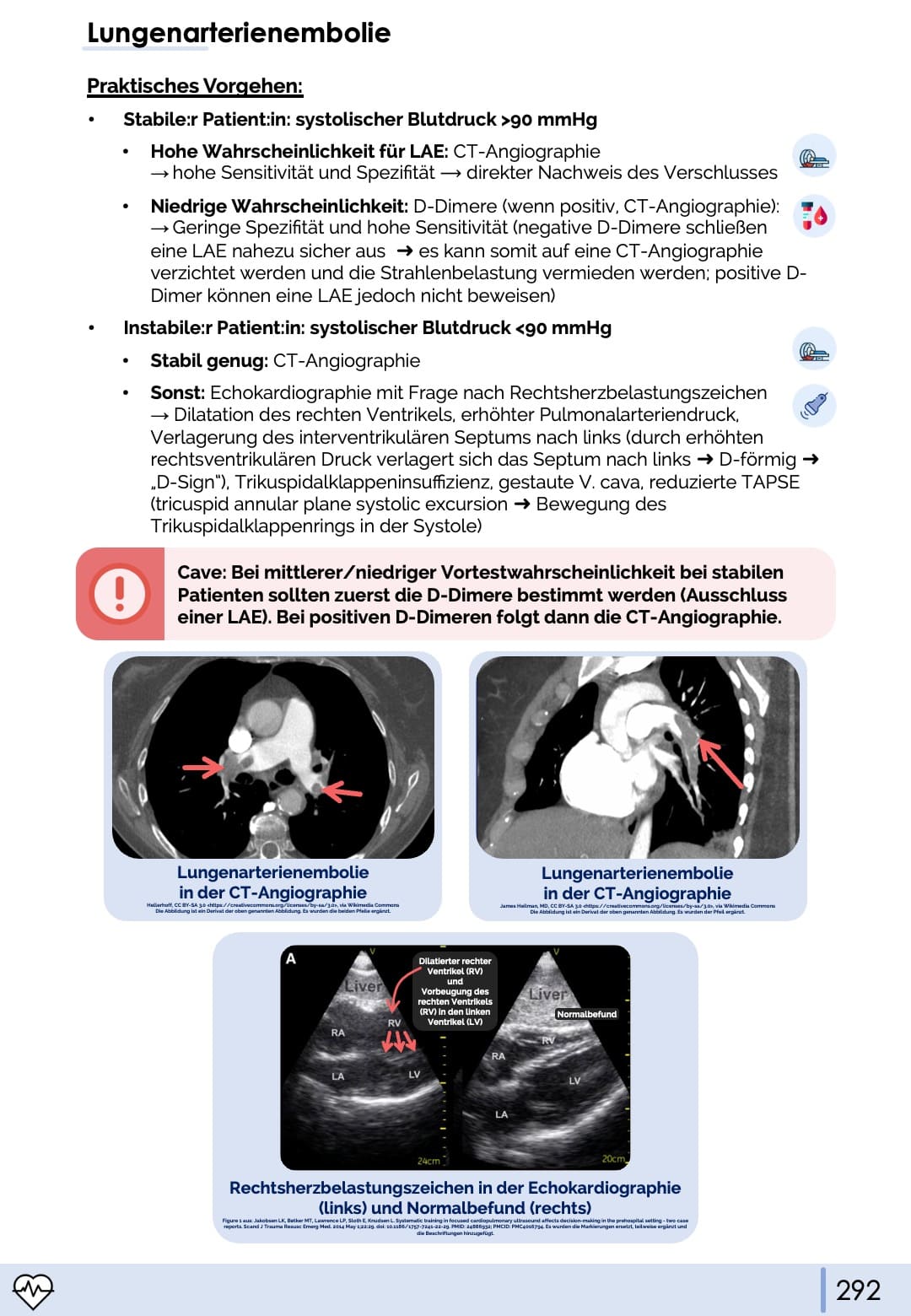 Lungenarterienembolie