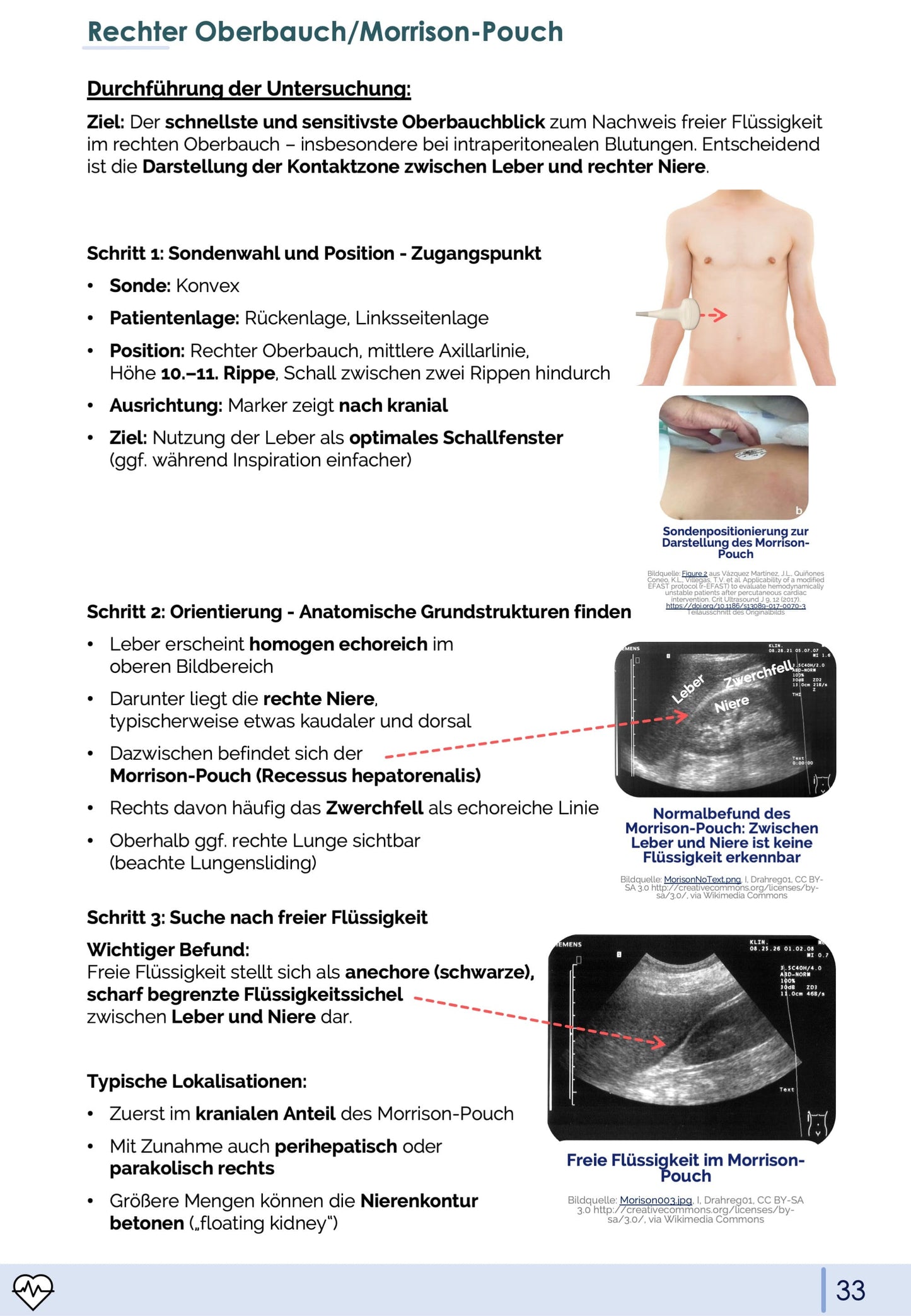 Notfall-Sonographie (eFAST)