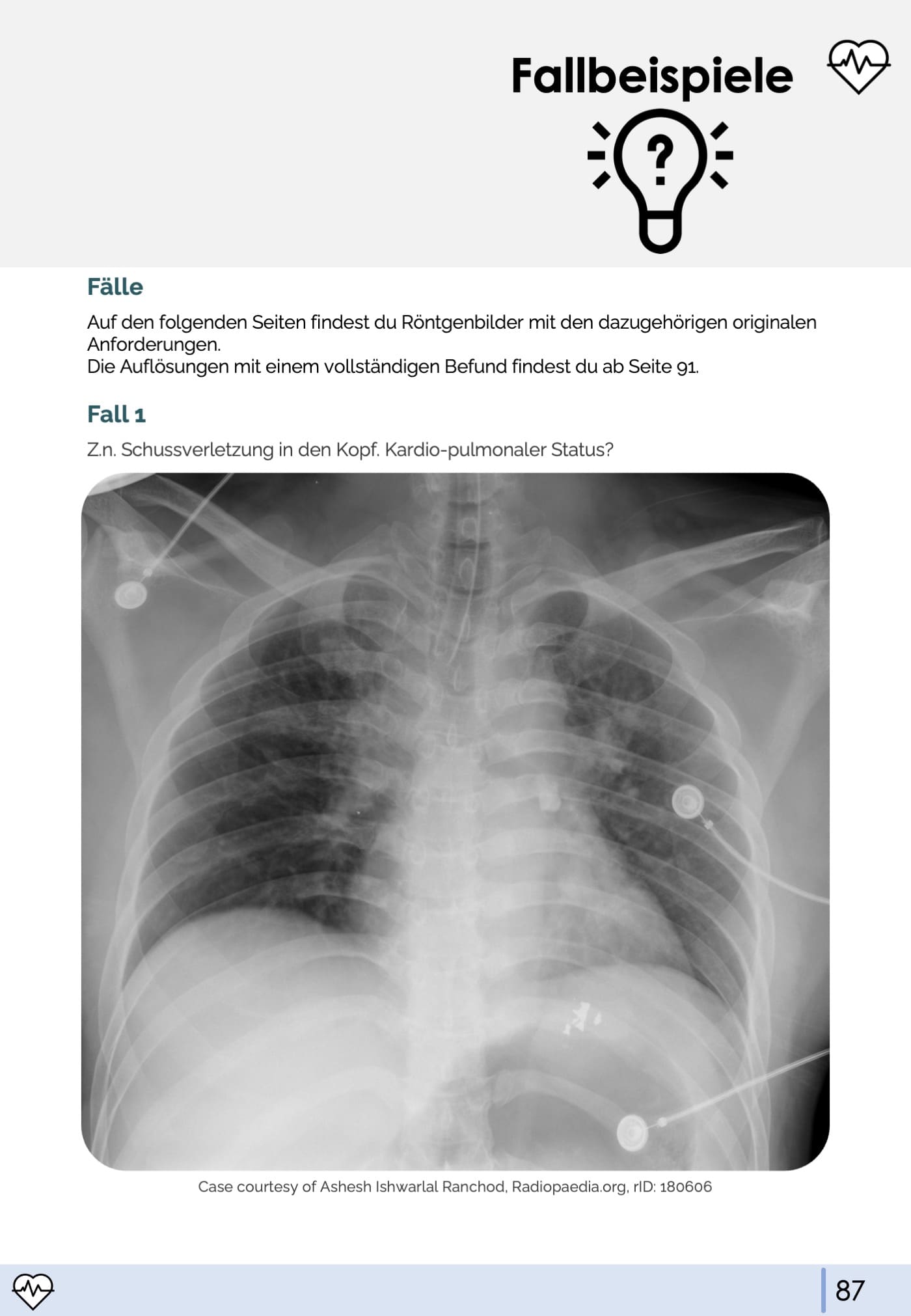 Röntgen-Thorax-Skript