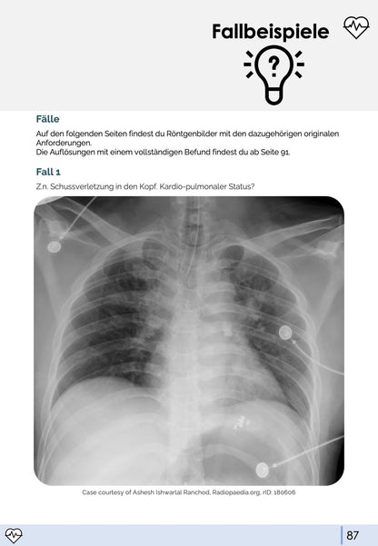 Röntgen-Thorax-Skript