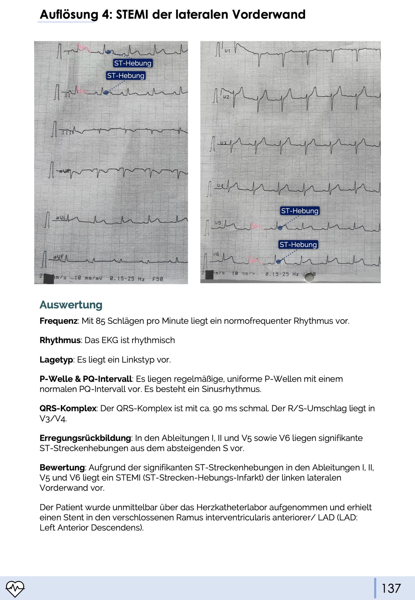 EKG-Skript (3. neue Auflage 02/2026)