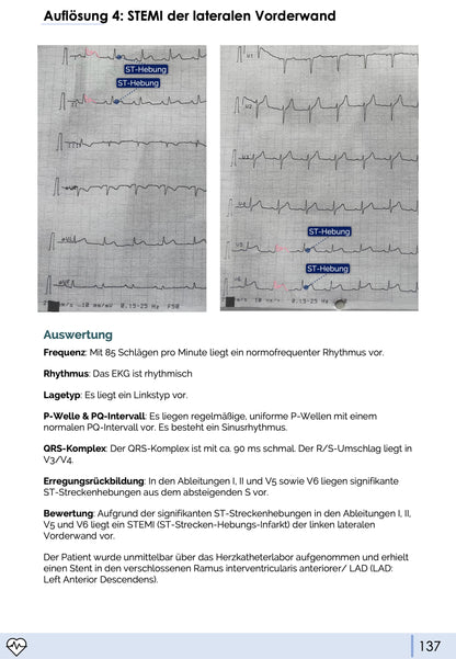 EKG-Skript (3. neue Auflage 02/2026)