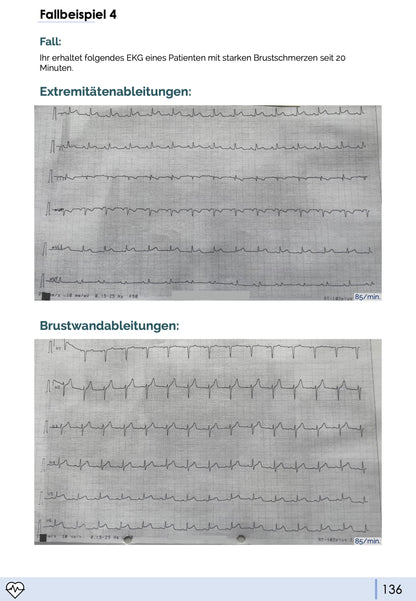 EKG-Skript (3. neue Auflage 02/2026)