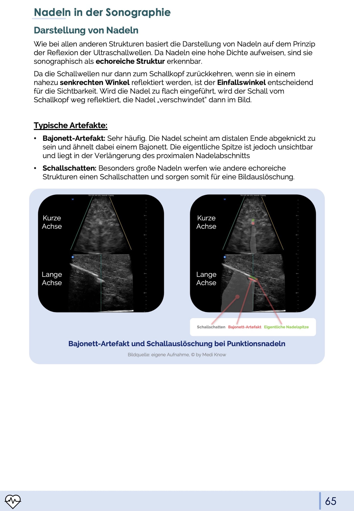 Notfall-Sonographie (eFAST)