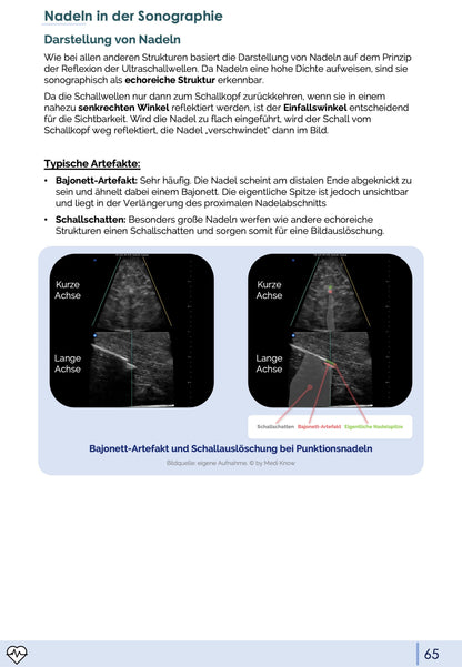 Notfall-Sonographie (eFAST)